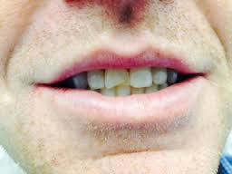 Boones Ferry Dental