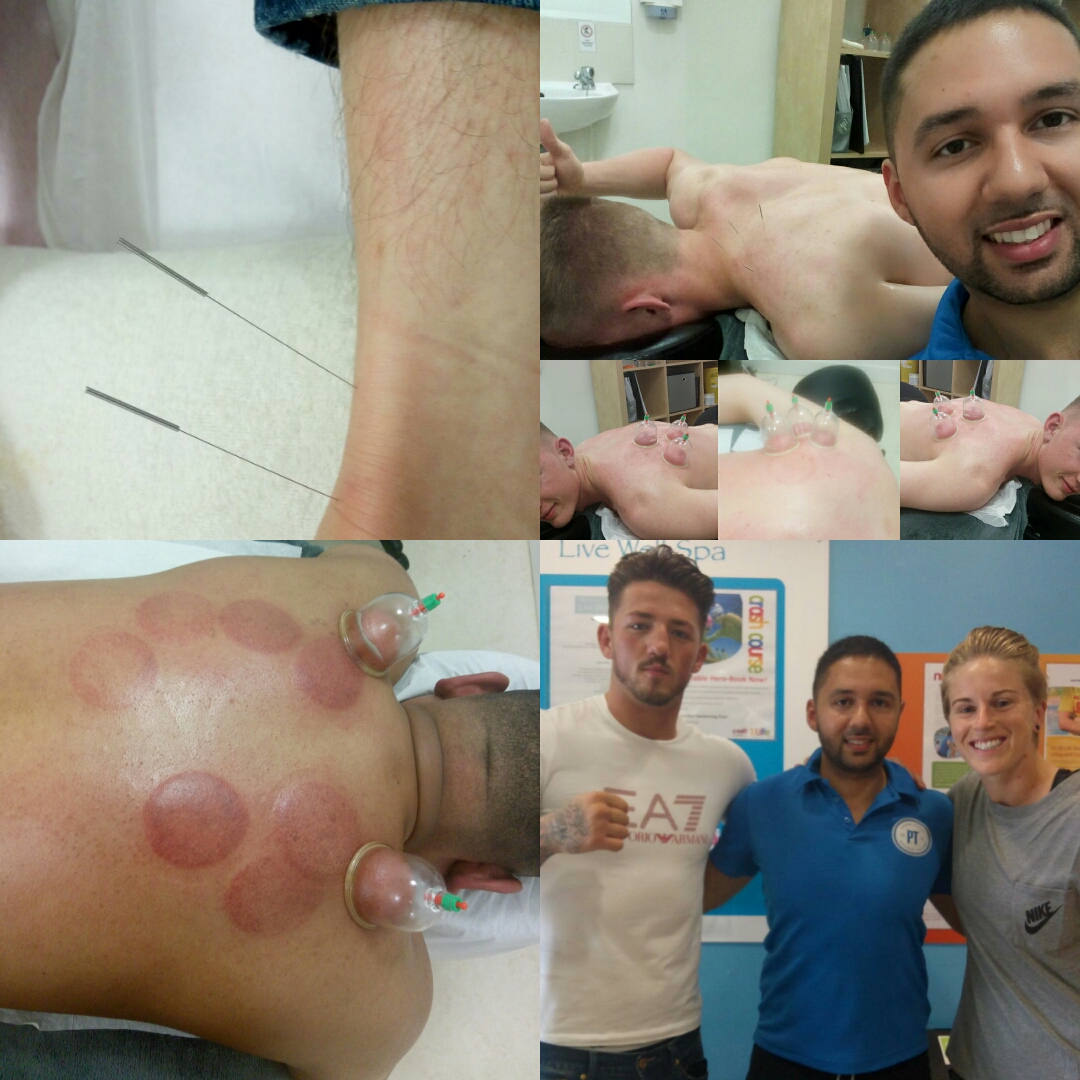 Mike Minerve Sports Therapy